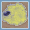 wideodermatoskopia